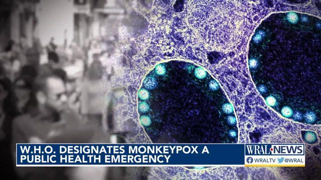 WHO declares monkeypox a global emergency