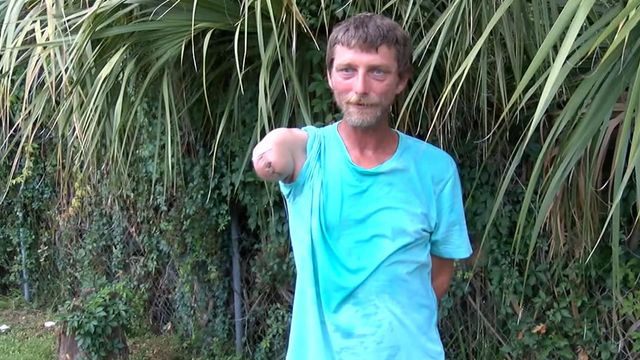 Man spends three days lost in swamp after losing arm in gator attack 
