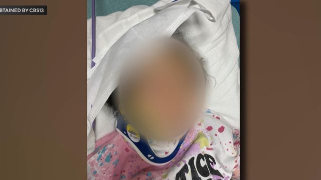 Deer accident leaves 10-year-old with fractured skull
