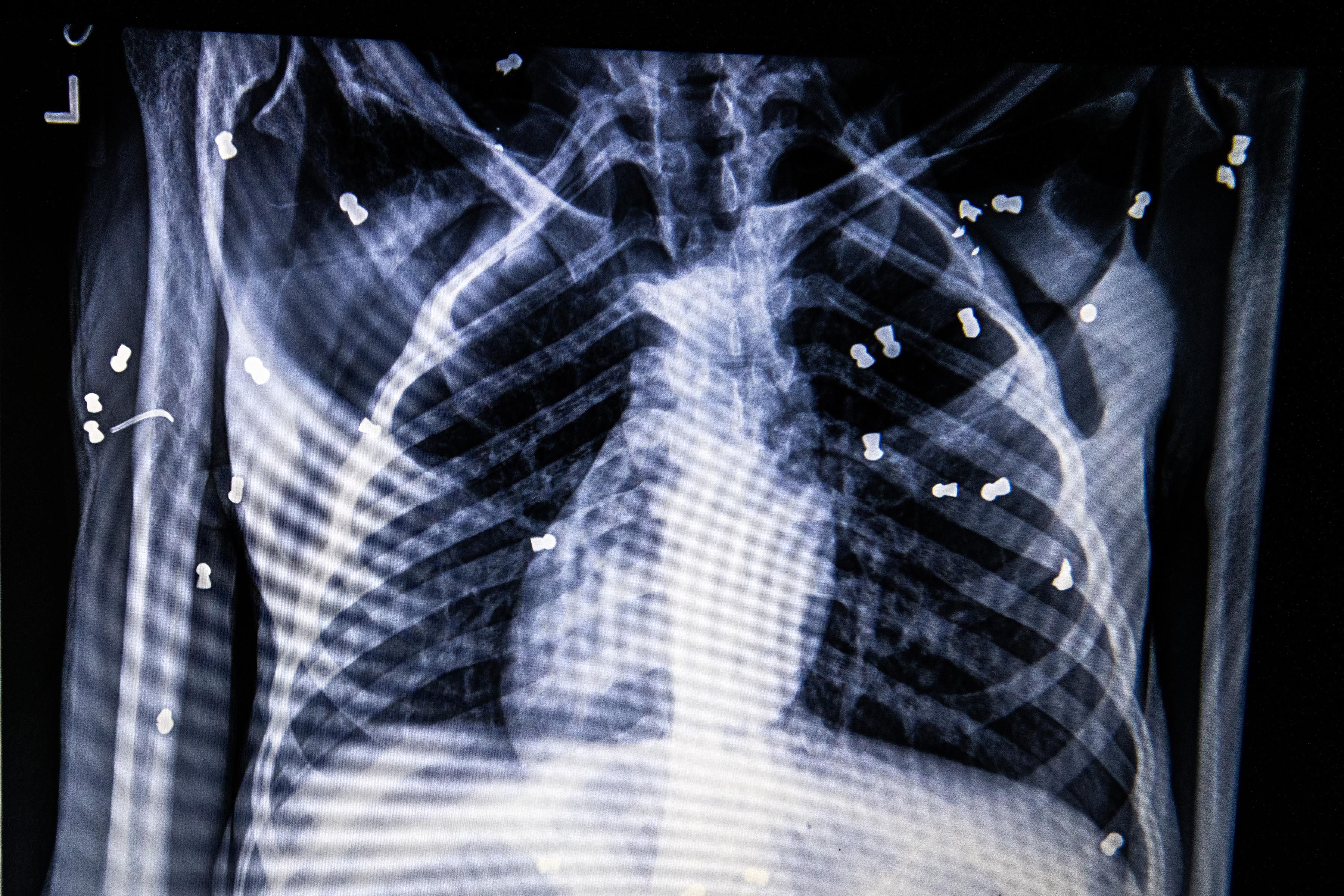 This day in history: German scientist discovers X-rays