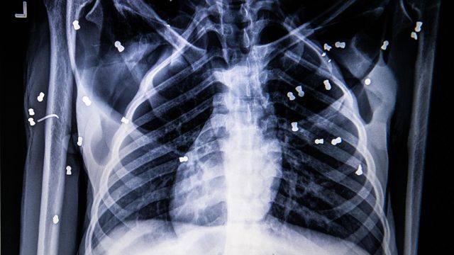 This day in history: German scientist discovers X-rays