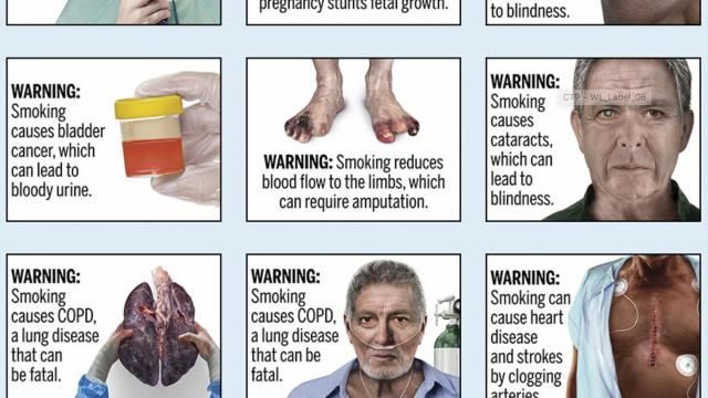 FILE - This image provided by the U.S. Food and Drug Administration, Thursday, Aug. 15, 2019, shows proposed cigarette warning labels. A federal rule requiring that cigarette packs and advertising include graphic images demonstrating the effects of smoking, including pictures of smoke-damaged lungs and feet blackened by diminished blood flow, does not violate the First Amendment, a federal appeals court ruled Thursday, March 21, 2024. (FDA via AP, File) FILE - This image provided by the U.S. Food and Drug Administration, Thursday, Aug. 15, 2019, shows proposed cigarette warning labels. A federal rule requiring that cigarette packs and advertising include graphic images demonstrating the effects of smoking, including pictures of smoke-damaged lungs and feet blackened by diminished blood flow, does not violate the First Amendment, a federal appeals court ruled Thursday, March 21, 2024. (FDA via AP, File)
