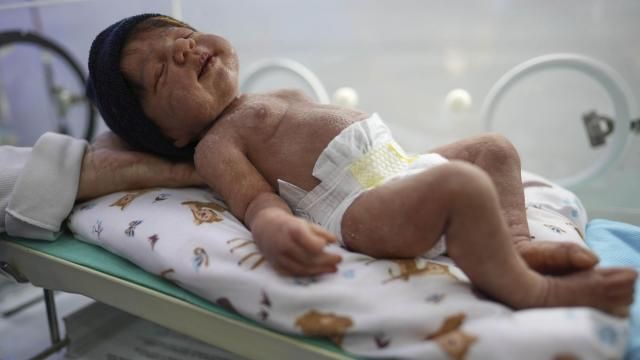 A hyper-realistic reborn baby doll lies in an incubator for sale at a store in Campinas, Brazil Saturday, May 24, 2025. (AP Photo/Andre Penner)