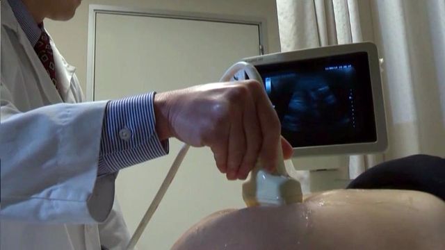 Law requires ultrasounds from some abortions be sent to DHHS