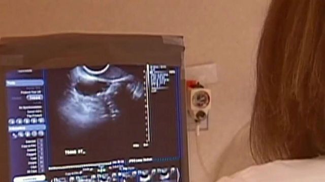'Born alive' abortion bill riles up both sides on emotional issue