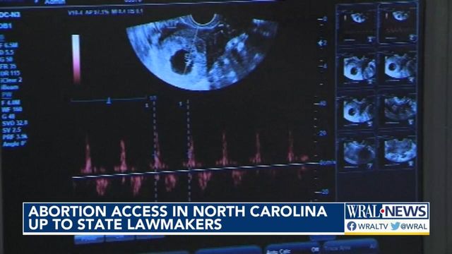 Abortion access in North Carolina up to state lawmakers