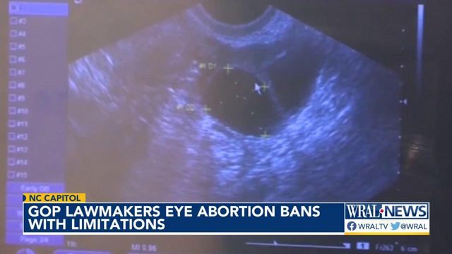 NC GOP working toward more restrictive abortion laws