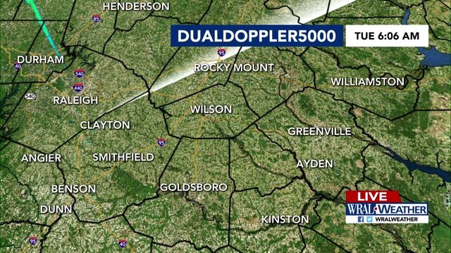 Live DUALDoppler5000