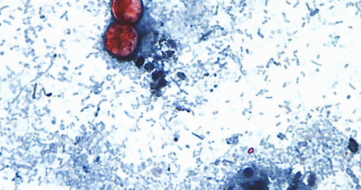 Foodborne illnesses at restaurant chains are rare but can sicken customers