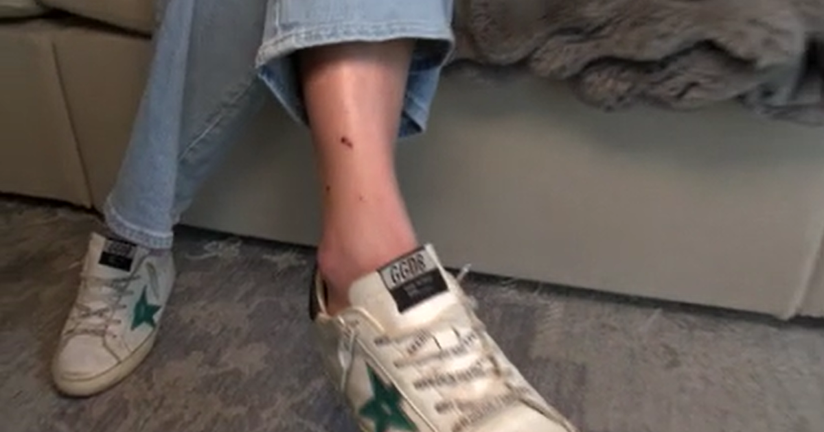 Wilmington woman says she was attacked by otter in Cary while cheering marathoners