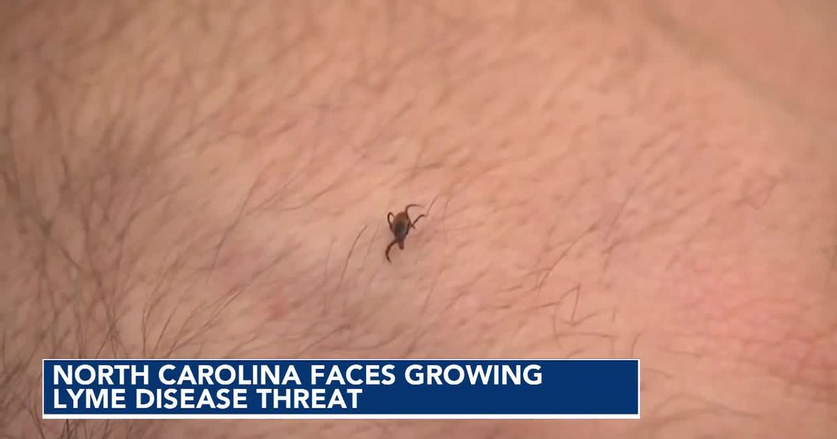 Ticks carrying Lyme disease are gaining ground in North Carolina, study finds