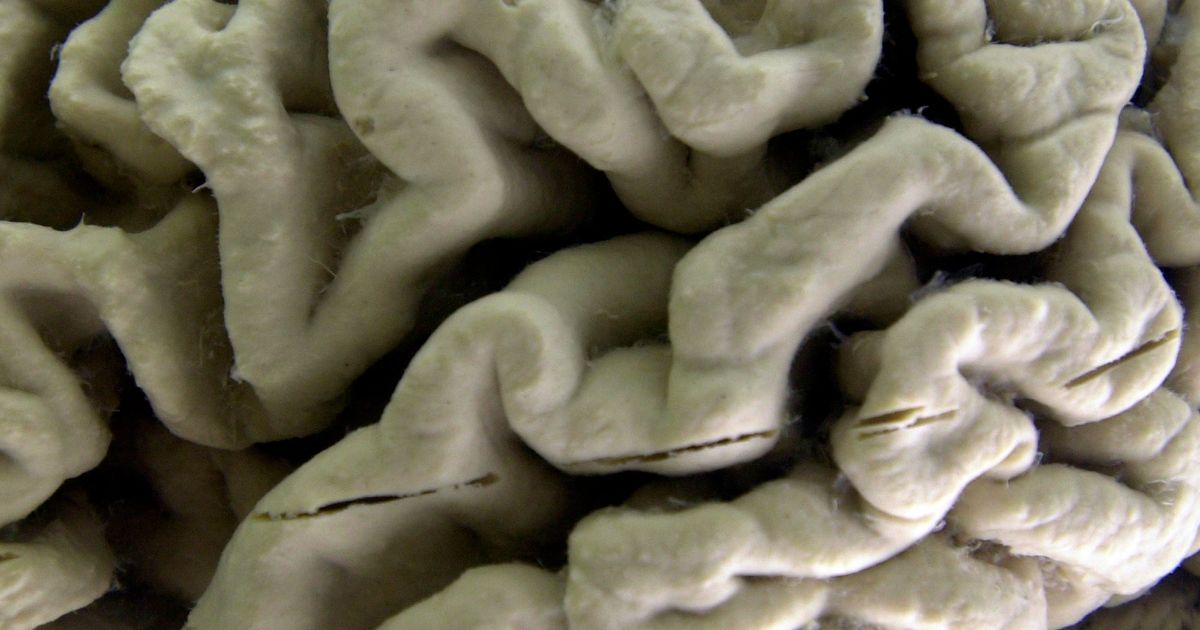 Study shows a blood test can help identify healthy people at high risk for Alzheimer's disease