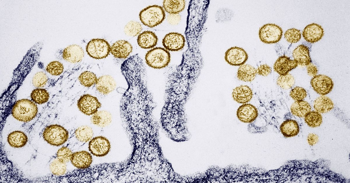 What is hantavirus and how does it spread?